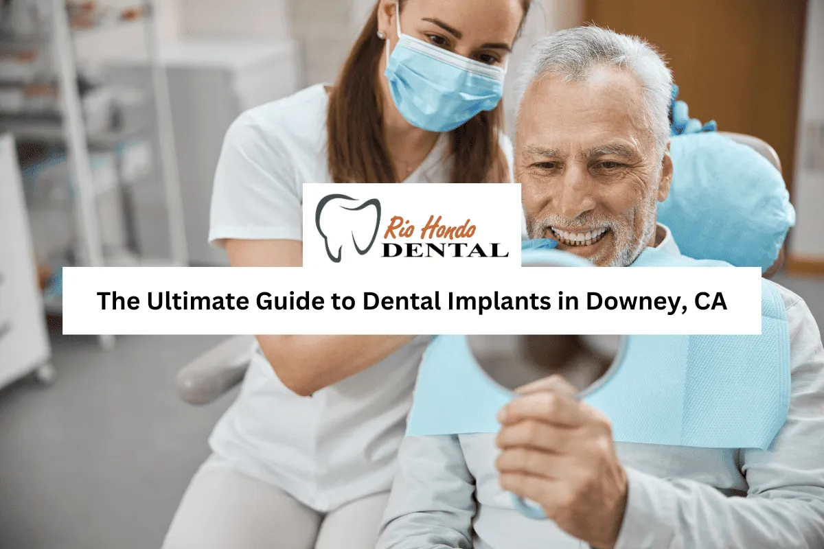 The Ultimate Guide to Dental Implants in Downey, CA