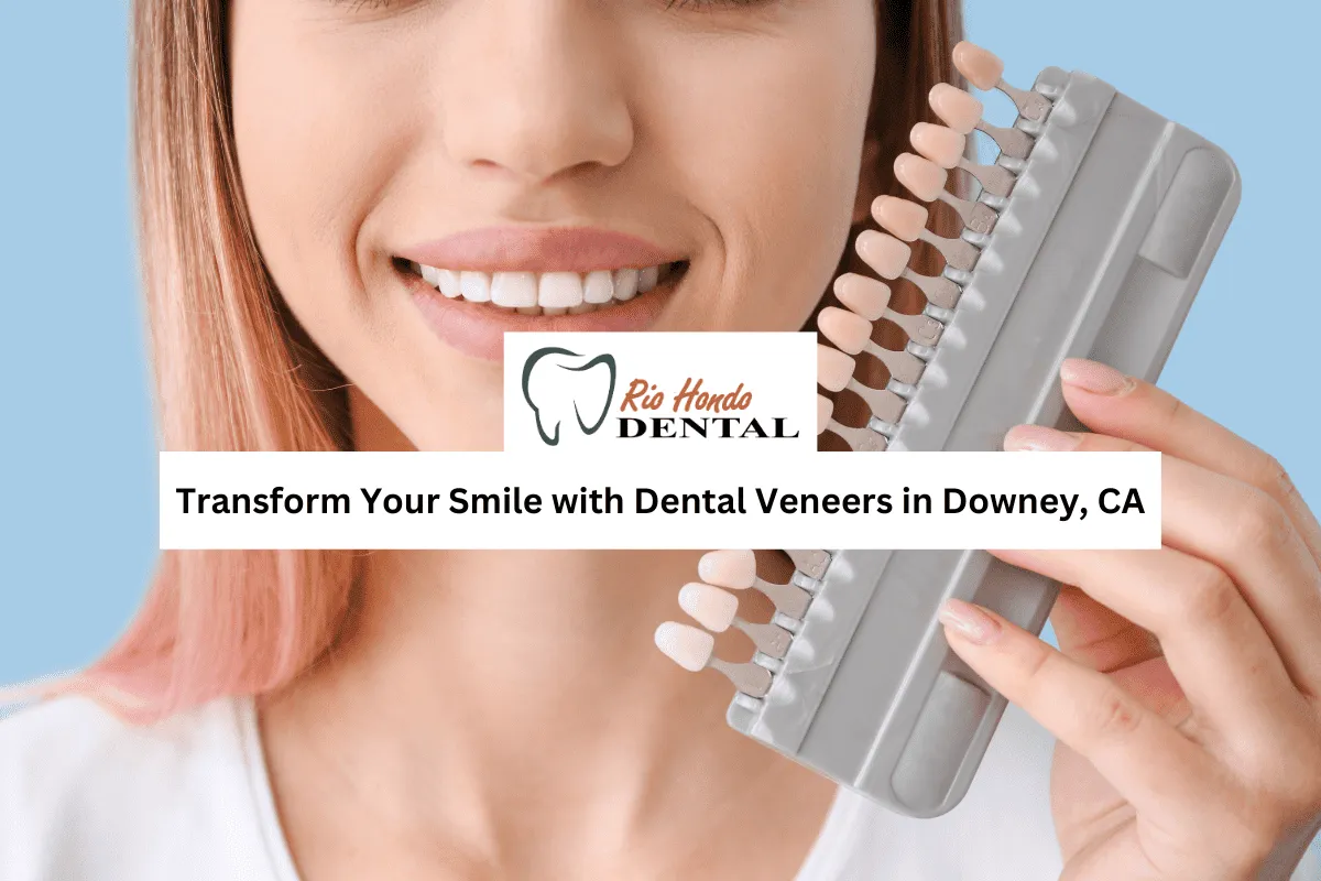 Transform Your Smile with Dental Veneers in Downey, CA