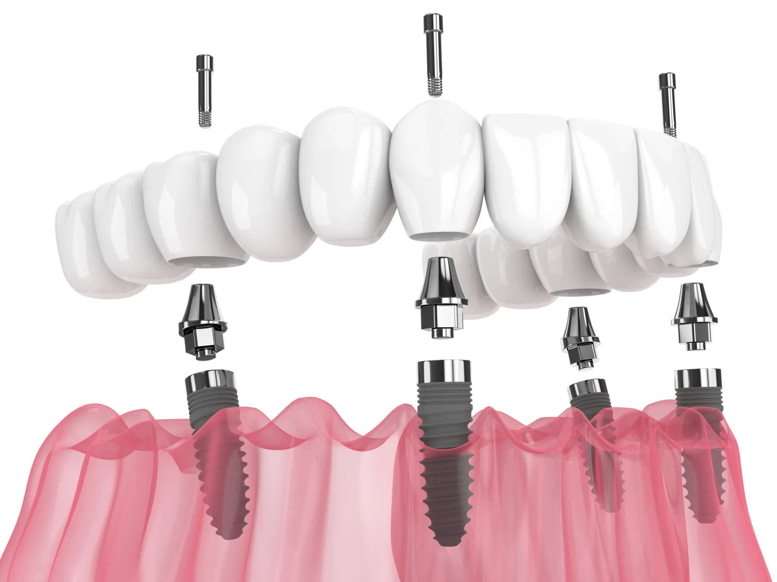Modern treatment room at Rio Hondo Dental Office in Downey, CA