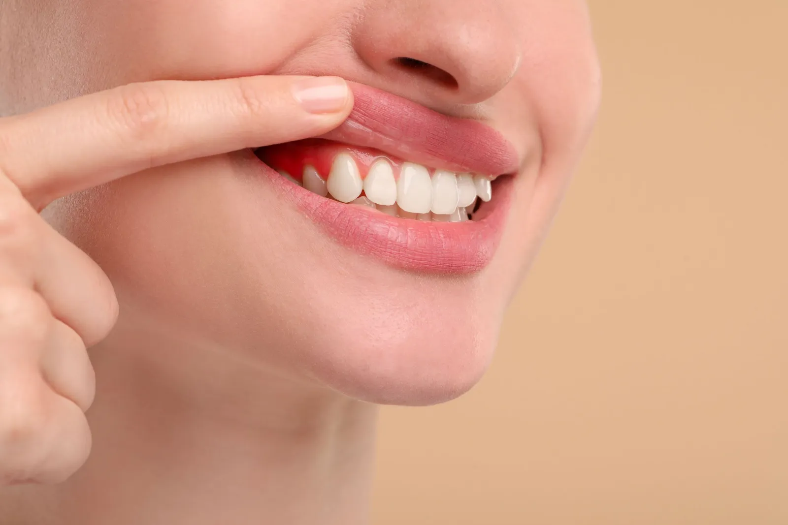 Sensitivity After Whitening? Here’s What Downey Patients Should Expect