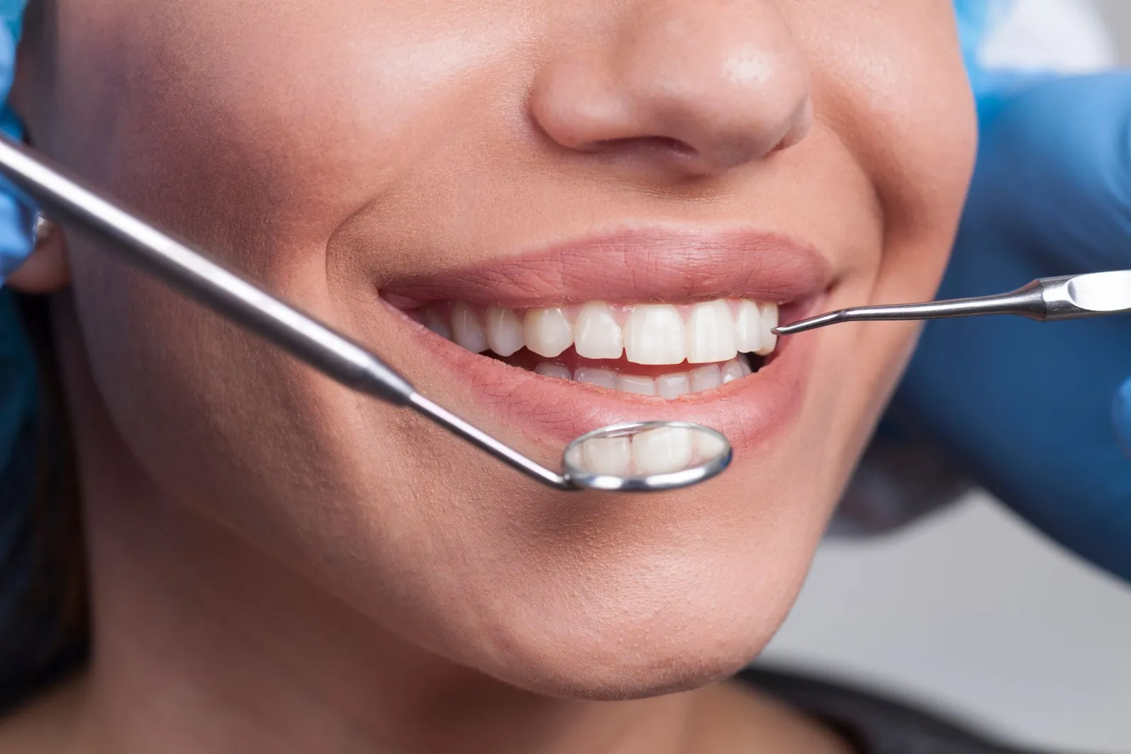 Dentist Near Pico Rivera: Why Hundreds of Families Choose Rio Hondo Dental